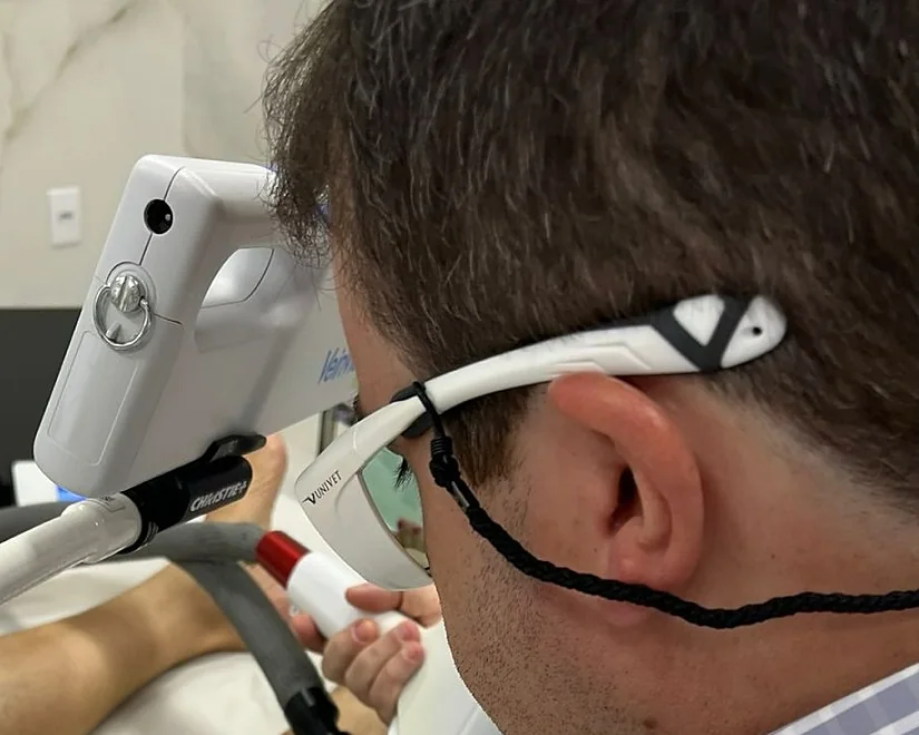Dr. Diego Lima de óculos de proteção aplicando o laser transdérmico na perna de uma paciente
